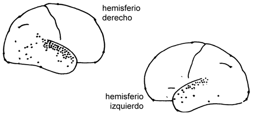 Figura 5. Mapas resumen de los dos hemisferios cerebrales